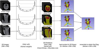 Deep Learning-Augmented Head and Neck Organs at Risk Segmentation From CT Volumes